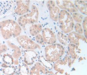 Immunohistochemistry (Formalin/PFA-fixed paraffin-embedded sections) - Anti-Pannexin 1 antibody (AB233479)
