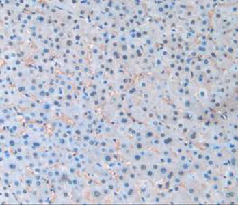 Immunohistochemistry (Formalin/PFA-fixed paraffin-embedded sections) - Anti-Pannexin 1 antibody (AB233479)