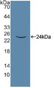 Western blot - Anti-Pannexin 1 antibody (AB233479)