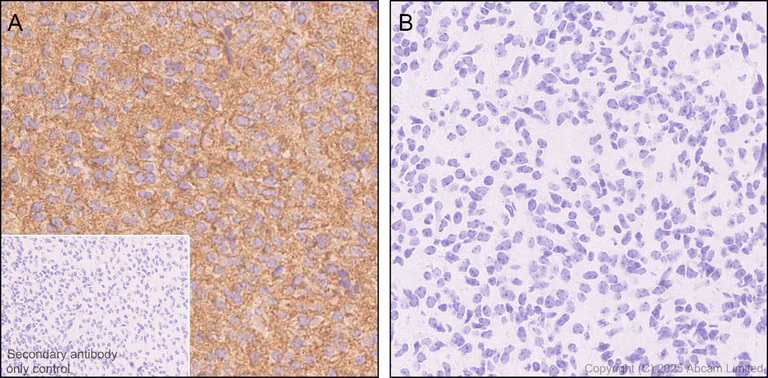 Immunohistochemistry (Formalin/PFA-fixed paraffin-embedded sections) - Anti-Pannexin 1 antibody [EPR28631-135] (AB325529)