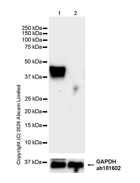 Western blot - Anti-Pannexin 1 antibody [EPR28631-135] (AB325529)