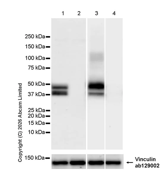 Western blot - Anti-Pannexin 1 antibody [EPR28631-135] - BSA and Azide free (AB325534)