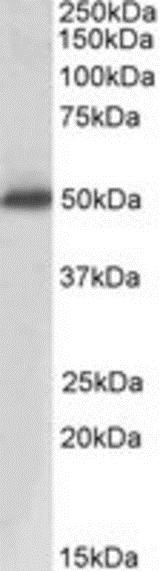 Western blot - Anti-PAP antibody (AB189343), expandable thumbnail