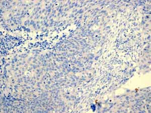 Immunohistochemistry (Formalin/PFA-fixed paraffin-embedded sections) - Anti-PAP antibody [EPR4066] (AB108984)