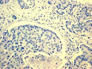 Immunohistochemistry (Formalin/PFA-fixed paraffin-embedded sections) - Anti-PAP antibody [EPR4066] (AB108984)