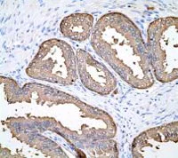 Immunohistochemistry (Formalin/PFA-fixed paraffin-embedded sections) - Anti-PAP antibody [EPR4066] (AB108984)