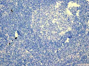 Immunohistochemistry (Formalin/PFA-fixed paraffin-embedded sections) - Anti-PAP antibody [EPR4066] (AB108984)