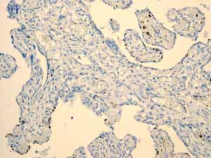 Immunohistochemistry (Formalin/PFA-fixed paraffin-embedded sections) - Anti-PAP antibody [EPR4066] (AB108984)