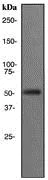 Western blot - Anti-PAP antibody [EPR4066] (AB108984)