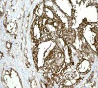Immunohistochemistry (Formalin/PFA-fixed paraffin-embedded sections) - Anti-PAP antibody [EPR4066] - BSA and Azide free (AB247732)