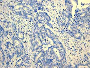 Immunohistochemistry (Formalin/PFA-fixed paraffin-embedded sections) - Anti-PAP antibody [EPR4066] - BSA and Azide free (AB247732)