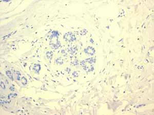 Immunohistochemistry (Formalin/PFA-fixed paraffin-embedded sections) - Anti-PAP antibody [EPR4066] - BSA and Azide free (AB247732)