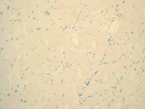 Immunohistochemistry (Formalin/PFA-fixed paraffin-embedded sections) - Anti-PAP antibody [EPR4066] - BSA and Azide free (AB247732)