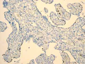Immunohistochemistry (Formalin/PFA-fixed paraffin-embedded sections) - Anti-PAP antibody [EPR4066] - BSA and Azide free (AB247732)
