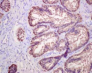 Immunohistochemistry (Formalin/PFA-fixed paraffin-embedded sections) - Anti-PAP antibody [EPR4067] (ab109004), expandable thumbnail