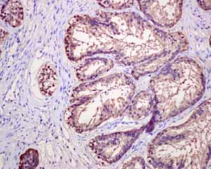 Immunohistochemistry (Formalin/PFA-fixed paraffin-embedded sections) - Anti-PAP antibody [EPR4067] (AB109004)