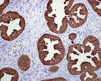 Immunohistochemistry (Formalin/PFA-fixed paraffin-embedded sections) - Anti-PAP antibody [EPR4067] (AB109004)