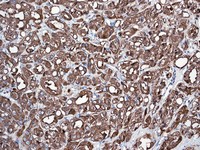 Immunohistochemistry (Formalin/PFA-fixed paraffin-embedded sections) - Anti-PAP antibody [EPR4067] (AB109004), expandable thumbnail