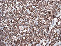 Immunohistochemistry (Formalin/PFA-fixed paraffin-embedded sections) - Anti-PAP antibody [EPR4067] (AB109004)