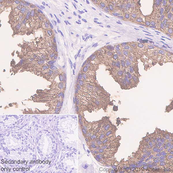 Immunohistochemistry (Formalin/PFA-fixed paraffin-embedded sections) - Anti-PAP antibody [EPR4067] (AB109004), expandable thumbnail