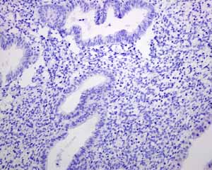 Immunohistochemistry (Formalin/PFA-fixed paraffin-embedded sections) - Anti-PAP antibody [EPR4067] (ab109004), expandable thumbnail