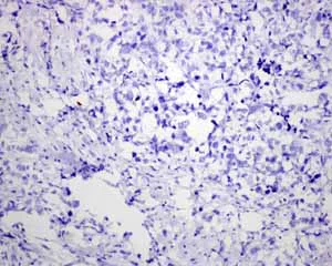 Immunohistochemistry (Formalin/PFA-fixed paraffin-embedded sections) - Anti-PAP antibody [EPR4067] (AB109004)