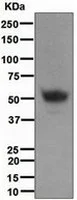 Western blot - Anti-PAP antibody [EPR4067] (AB109004)