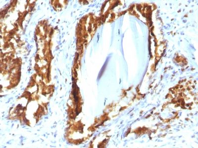 Immunohistochemistry (Formalin/PFA-fixed paraffin-embedded sections) - Anti-PAP antibody [rACPP/1338] (AB238037)