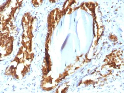 Immunohistochemistry (Formalin/PFA-fixed paraffin-embedded sections) - Anti-PAP antibody [rACPP/1338] (AB238037)