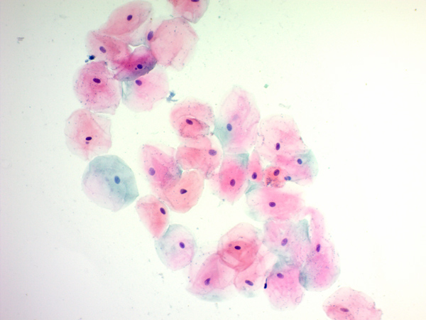 Immunohistochemistry (Formalin/PFA-fixed paraffin-embedded sections) - Papanicolaou (PAP) Red Stain Kit (Cytology Stain) (AB150679), expandable thumbnail