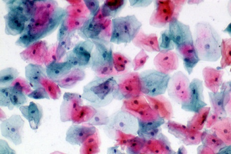 Immunohistochemistry (Formalin/PFA-fixed paraffin-embedded sections) - Papanicolaou (PAP) Red Stain Kit (Cytology Stain) (AB150679), expandable thumbnail