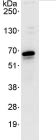 Immunoprecipitation - Anti-Papillary renal cell carcinoma antibody (AB86602), expandable thumbnail