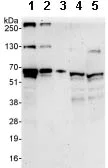 Western blot - Anti-Papillary renal cell carcinoma antibody (AB86602)