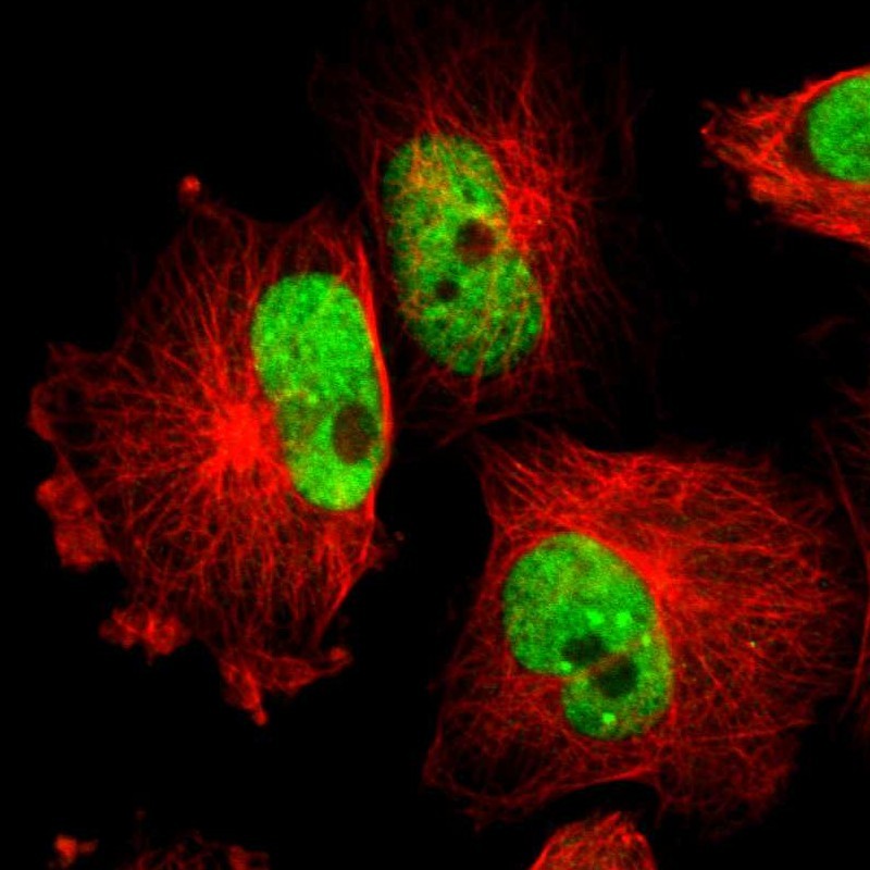 Immunocytochemistry/ Immunofluorescence - Anti-PAPOLA antibody (AB251660), expandable thumbnail