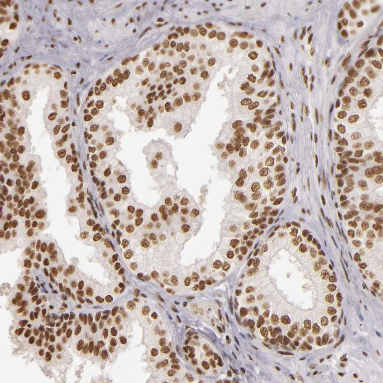 Immunohistochemistry (Formalin/PFA-fixed paraffin-embedded sections) - Anti-PAPOLA antibody (AB251660)