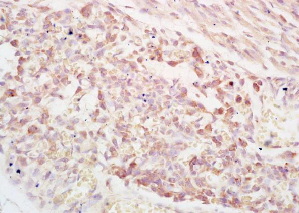 Immunohistochemistry (Formalin/PFA-fixed paraffin-embedded sections) - Anti-PAPP A antibody (AB203683)