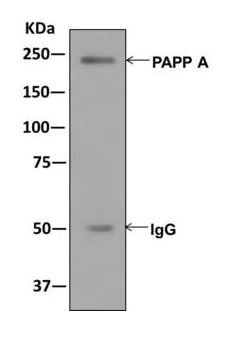 Immunoprecipitation - Anti-PAPP A antibody [EPR12897] (AB174314)