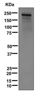 Western blot - Anti-PAPP A antibody [EPR12897] (AB174314)