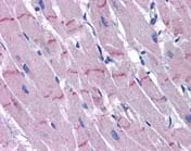 Immunohistochemistry (Formalin/PFA-fixed paraffin-embedded sections) - Anti-PAPP A2 antibody (AB117743)