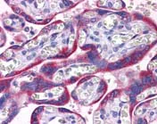 Immunohistochemistry (Formalin/PFA-fixed paraffin-embedded sections) - Anti-PAPP A2 antibody (AB117743)