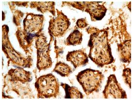Immunohistochemistry (Formalin/PFA-fixed paraffin-embedded sections) - Anti-PAPP A2 antibody [ABM4C62] (AB228434)