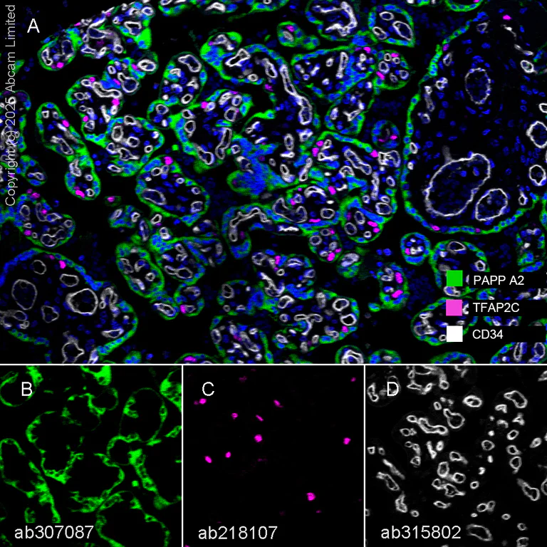 Multiplex immunohistochemistry - Anti-PAPP A2 antibody [EPR25642-91] (AB307087)