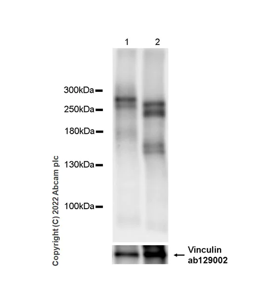 Western blot - Anti-PAPP A2 antibody [EPR25642-91] - BSA and Azide free (AB307088)
