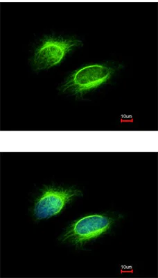 Immunocytochemistry/ Immunofluorescence - Anti-PAPSS1 antibody (AB155600)