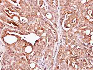 Immunohistochemistry (Formalin/PFA-fixed paraffin-embedded sections) - Anti-PAPSS1 antibody (AB155600)