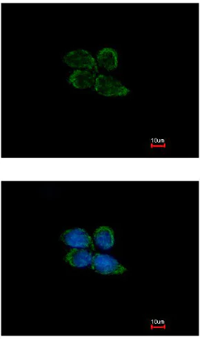 Immunocytochemistry/ Immunofluorescence - Anti-PAPSS2 antibody (AB155585)
