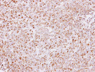 Immunohistochemistry (Formalin/PFA-fixed paraffin-embedded sections) - Anti-PAPSS2 antibody (AB155585)