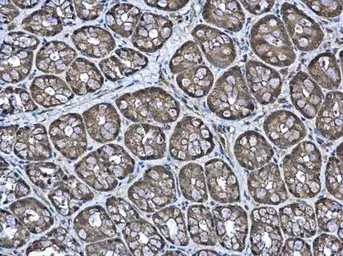 Immunohistochemistry (Formalin/PFA-fixed paraffin-embedded sections) - Anti-PAPSS2 antibody (AB155585)