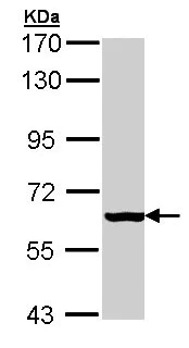 Western blot - Anti-PAPSS2 antibody (AB155585)