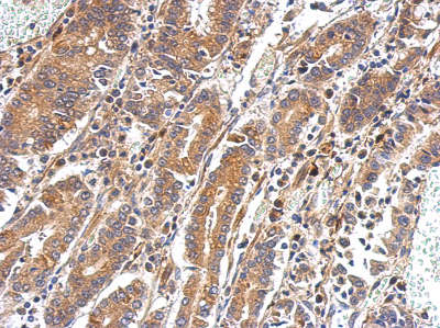 Immunohistochemistry (Formalin/PFA-fixed paraffin-embedded sections) - Anti-PAPSS2 antibody (AB155588), expandable thumbnail